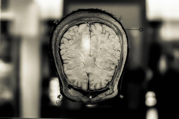 Bảo tàng não người là nơi hiếm hoi du khách có thể ngắm cận cảnh cấu tạo phức tạp nhất của một cơ thể, bộ não - Ảnh: Flickr